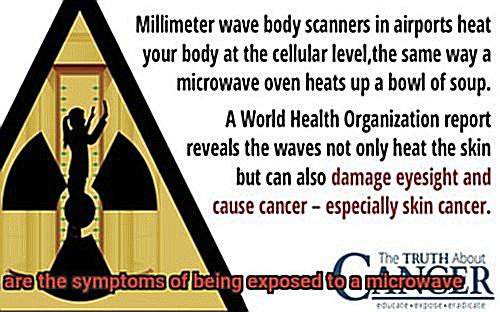 What are the symptoms of being exposed to a microwave-2