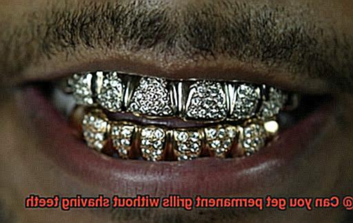 Can you get permanent grills without shaving teeth-4