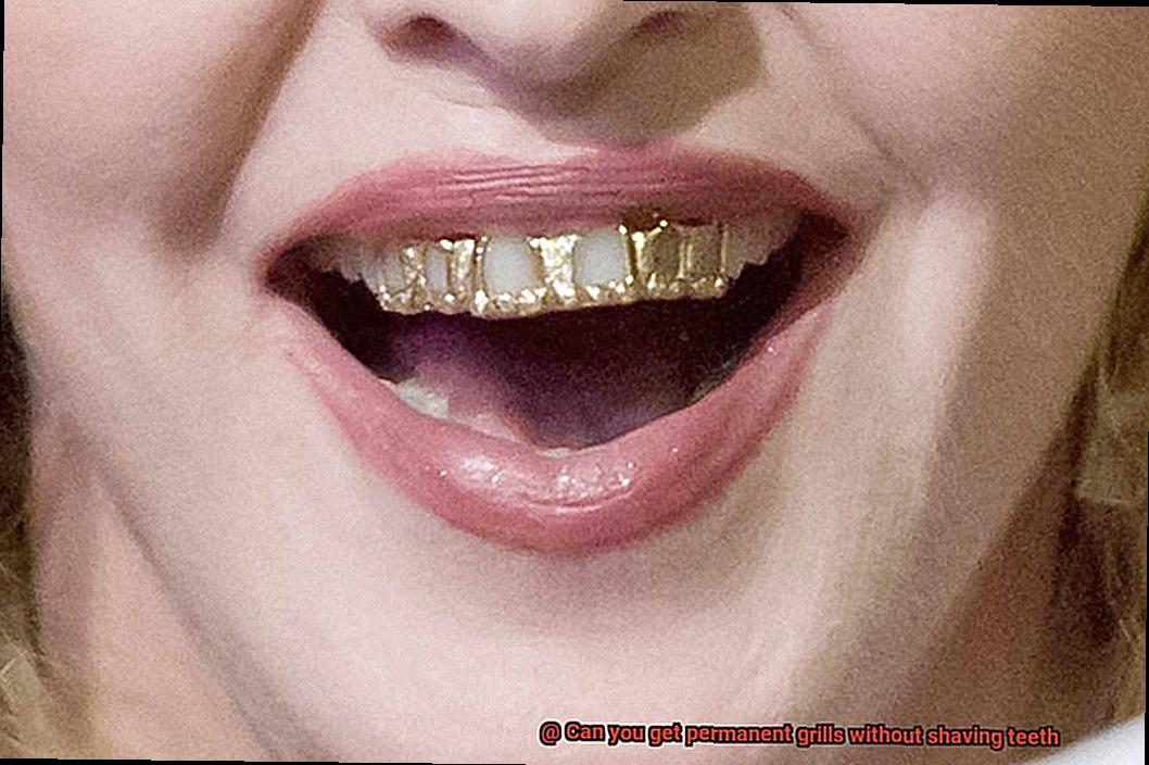 Can you get permanent grills without shaving teeth-2