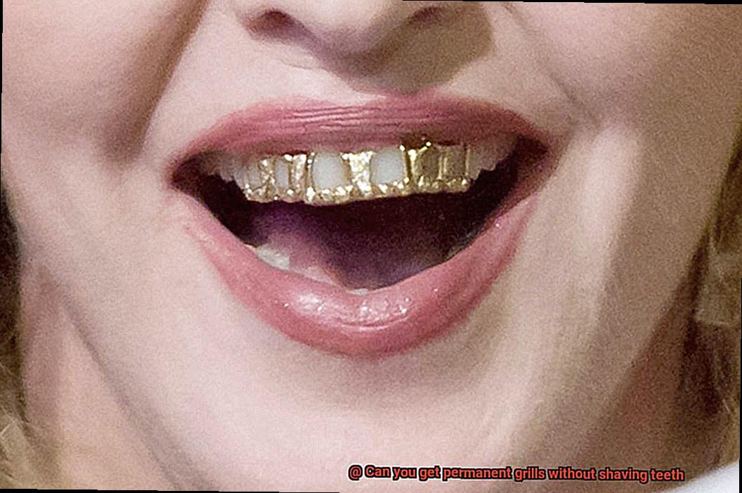 Can you get permanent grills without shaving teeth-2