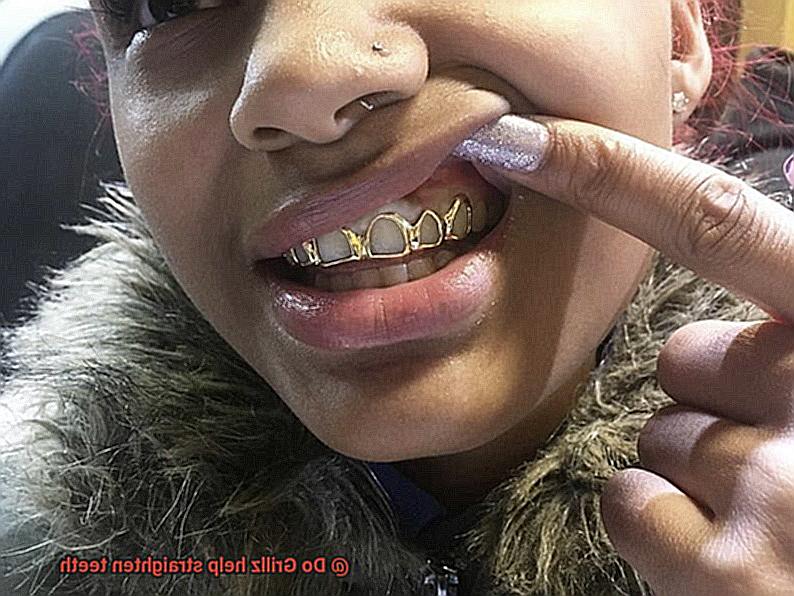 Do Grillz help straighten teeth-2
