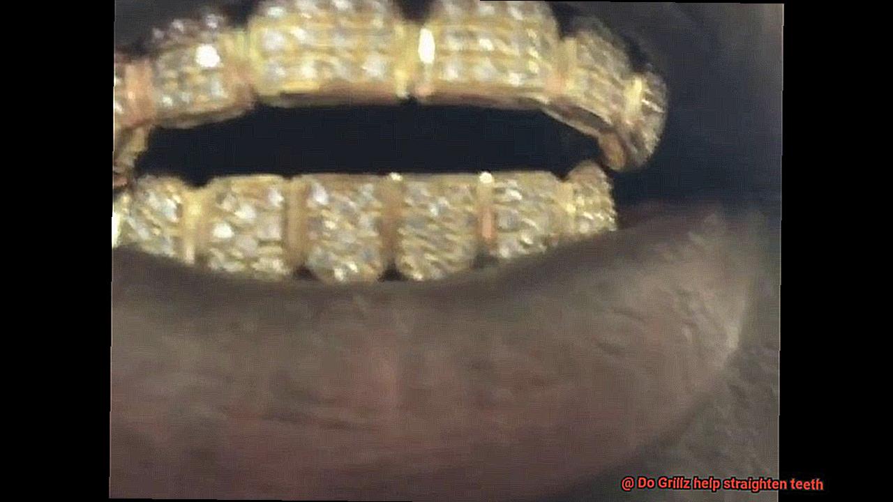 Do Grillz help straighten teeth-5