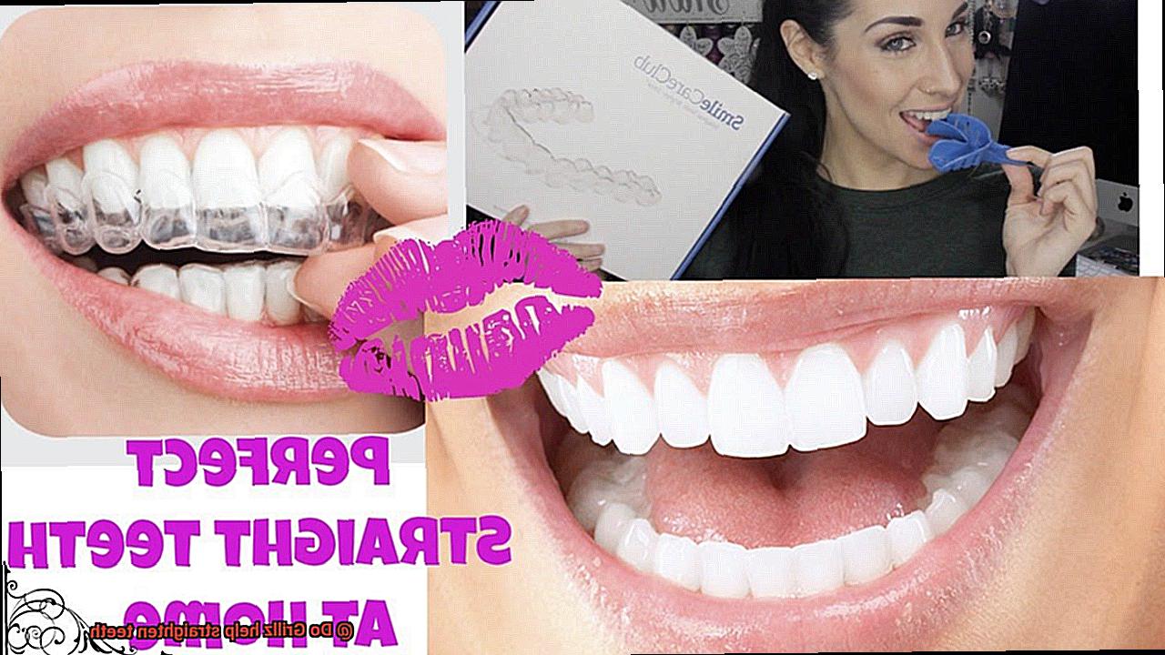 Do Grillz help straighten teeth-4