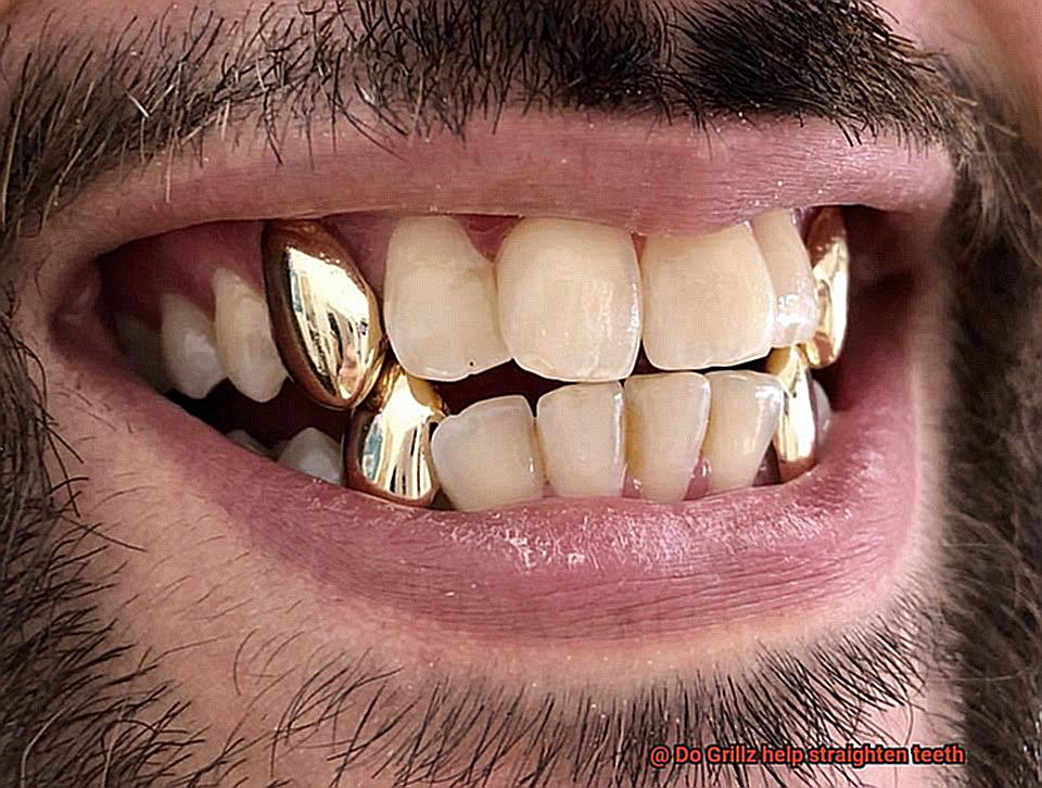 Do Grillz help straighten teeth-3
