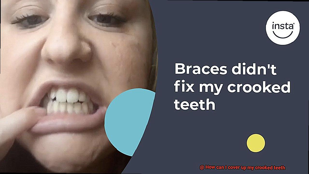 How can I cover up my crooked teeth-3